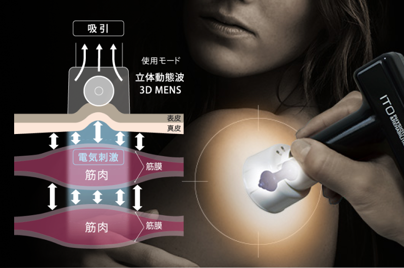 イメージ図：電気刺激＋経皮的吸引のコンビネーション