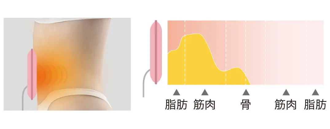 パッド型コイル導子の作用イメージ