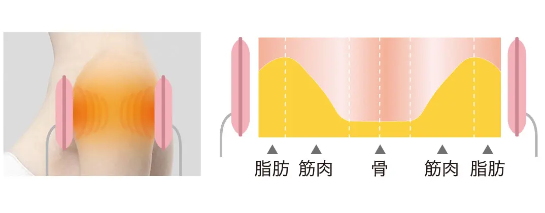 パッド型コイル導子の作用イメージ