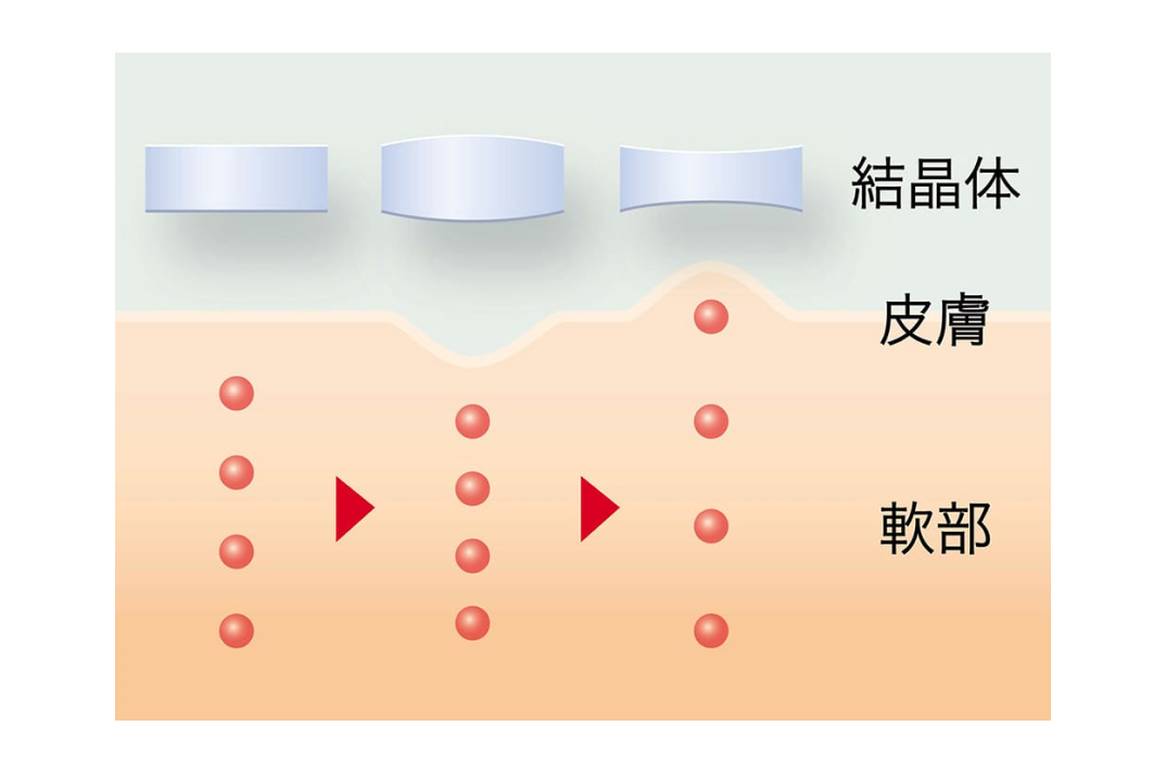 イメージ図：1秒間に数百万回のミクロマッサージ効果